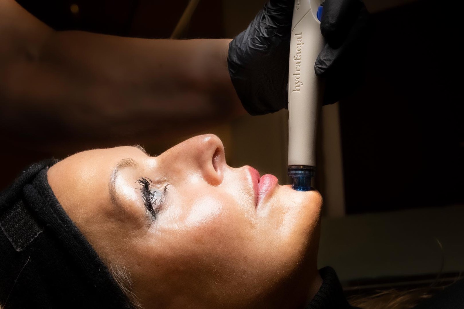 HydraFacial-behandling hos Sandefjord Medisinske Hudpleie