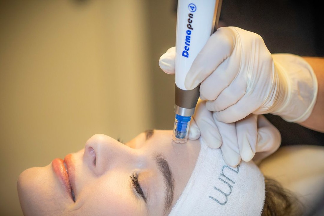 Mikroneedling med Dermapen